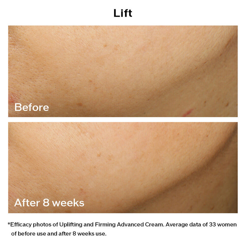 Uplifting and Firming Advanced Cream (Refill)