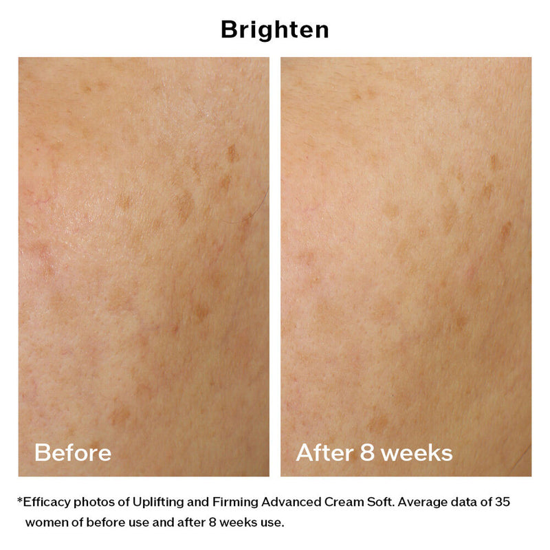Shiseido Vital Perfection Uplifting And Firming Advanced Soft Cream (refill) 50ml (Anti-Aging)