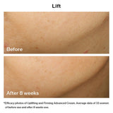 Shiseido Vital Perfection Uplifting And Firming Advanced Cream 50ml (Anti-Aging)